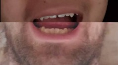 teeth